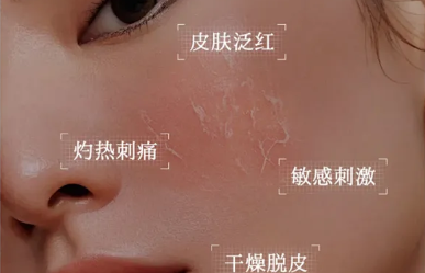 微肽生物——美容院專業(yè)線敏感肌修護(hù)產(chǎn)品源頭供應(yīng)廠家